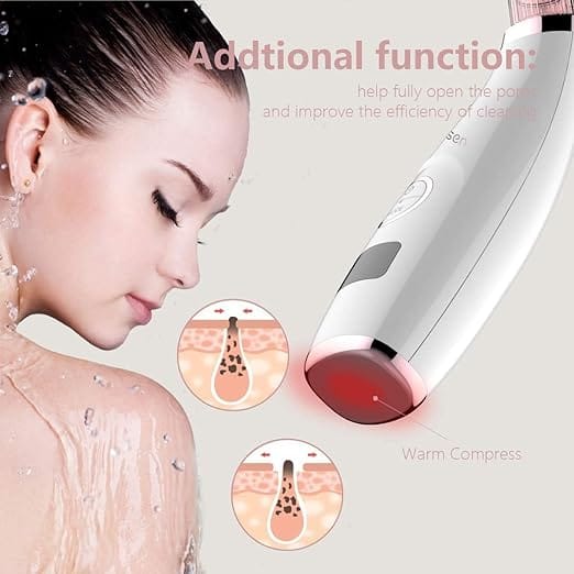 Mosen M1905 Blackhead Remover -Pink,5 Adjustable Level